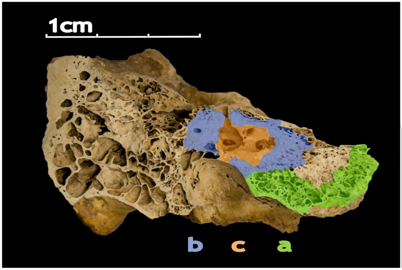 A macro image of the petrous bone. 3 sections are color coded A (green), B (blue), and C (red)