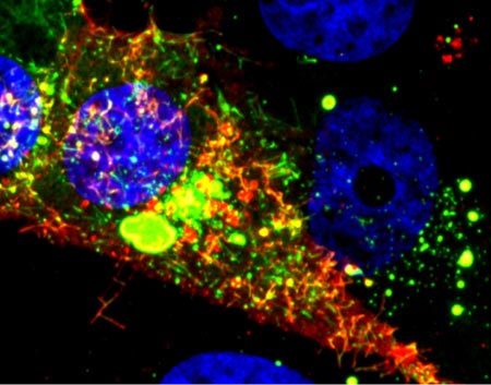 Viral RNA (red) in an RSV-infected cell. Credit: Eric Alonas and Philip Santangelo, Georgia Institute of Technology and Emory University.