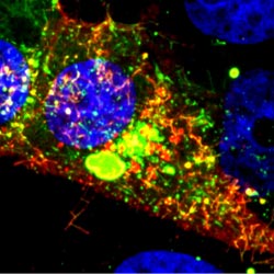 RSV infected cell