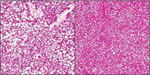 Liver cells of obese mice treated with valproic acid (right) and untreated obese mice (left).