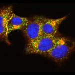 TMEM24 protein (green) and insulin (red) in pancreatic beta cells (yellow).  Credit: Balch Lab, the Scripps Research Institute.