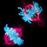 A cell in two stages of division: prometaphase (top) and metaphase (bottom). Credit: Lilian Kabeche, Dartmouth.