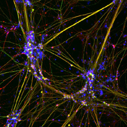 Web of neurons