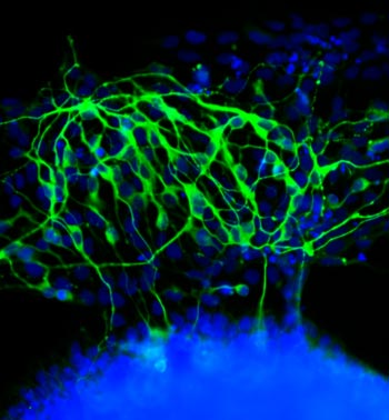Stem cells transform into neurons.