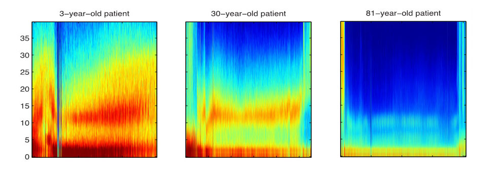 Image of scans of brain waves.