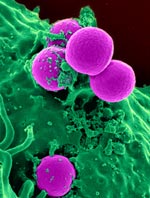 Antibiotic-resistant strains of Staphlyococcus aureus bacteria (purple) have become the most common cause of skin infections seen in hospital emergency departments. Credit: NIH’s National Institute of Allergy and Infectious Diseases.