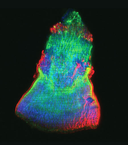 The isolated feeding tube of a flatworm.