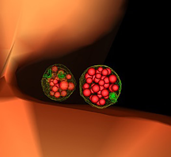 Yeast cell showing two mature, or “late” endosomes that are filled with small vesicles.