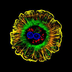 Digital Micrograph of a Hepatocyte