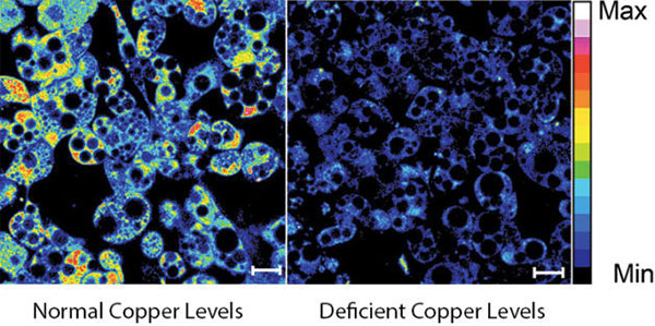 Fluorescent imaging of copper in white fat cells from mice.