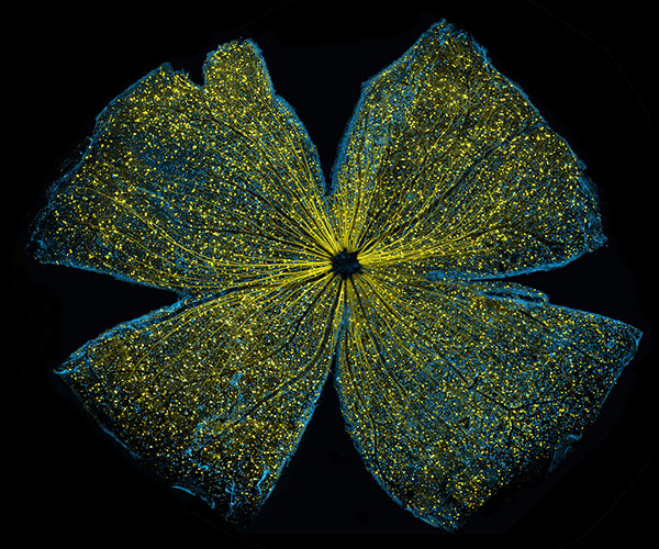 Retinal ganglion cells in the mouse.