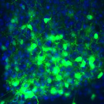 Master clock in mouse brain with the nuclei of the clock cells shown in blue and the VIP molecule shown in green. Credit: Cristina Mazuski in the lab of Erik Herzog, Washington University in St. Louis.