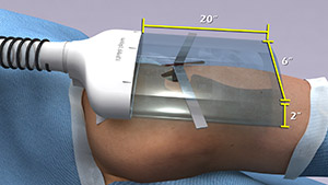 Air Barrier System