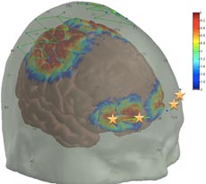 Pain responses the prefrontal cortex