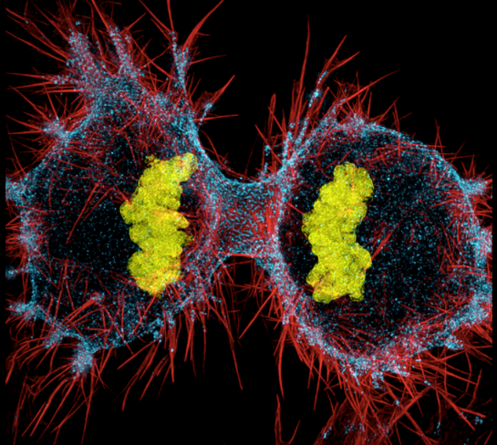 A human HeLa cell dividing. Each section has red, stringlike projections. The dividing cell is dotted in light blue, and the two centers of the dividing cell contain yellow clumps.