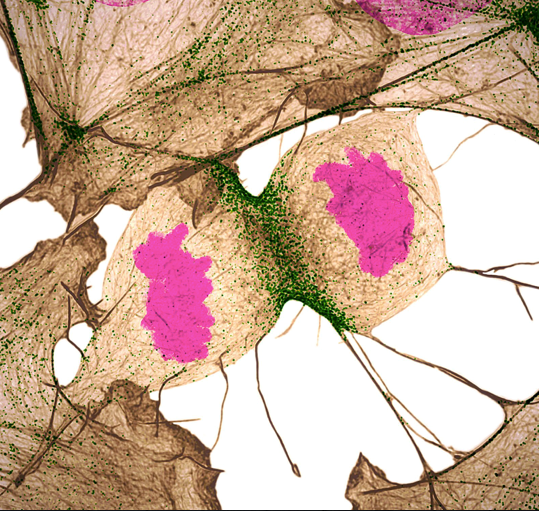 A human fibroblast cell dividing. A tan-colored area surrounds the cell that contains two magenta-colored centers. Green dots line the area where the cell is dividing.