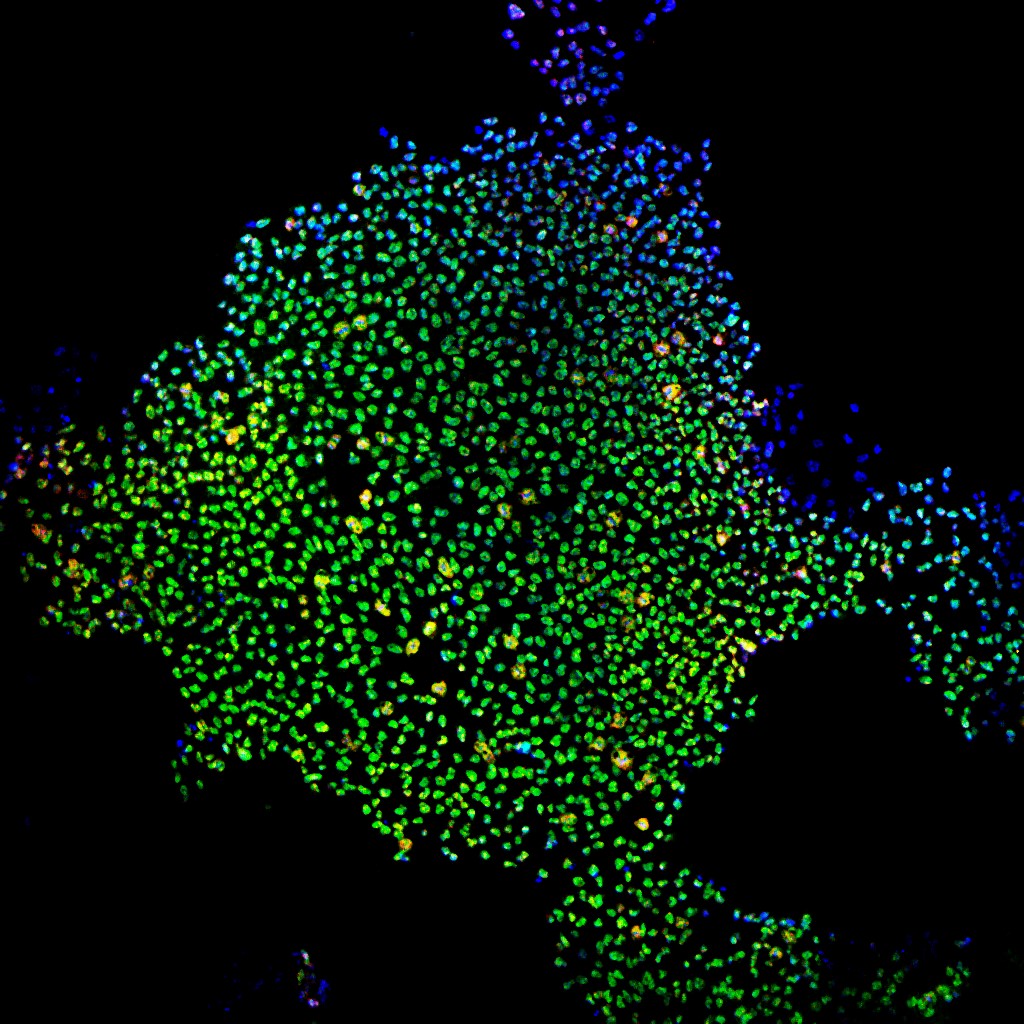 Induced stem cells made from adult skin cells stained green and blue and seen through a microscope.