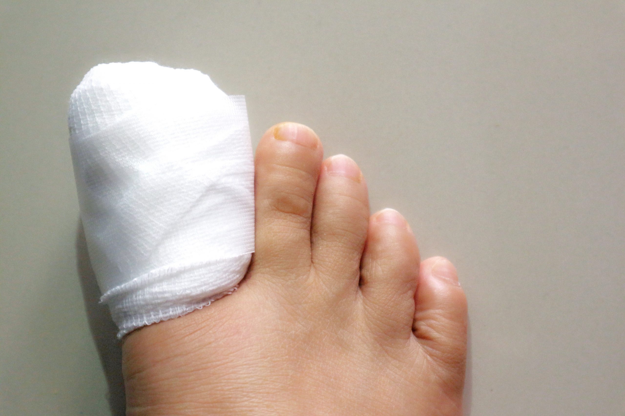A human foot with the big toe wrapped in white gauze.