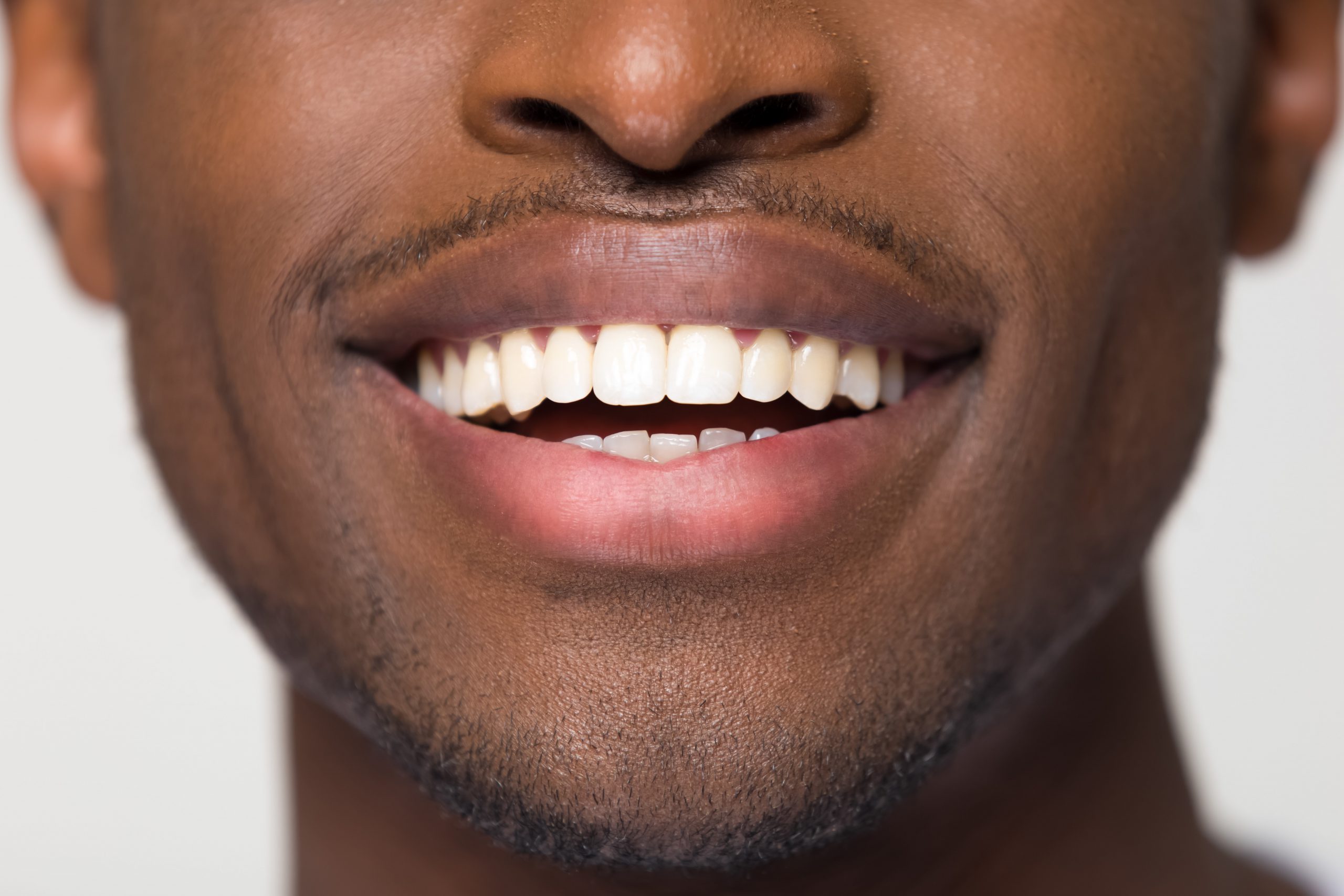 A man smiling in a way that shows his teeth.