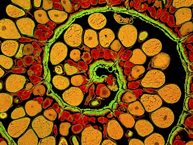 A spiral of orange and red cells.