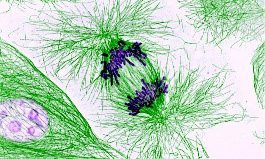 Chromosomes (short purple strands) being pulled apart by microtubules (long green fibers).