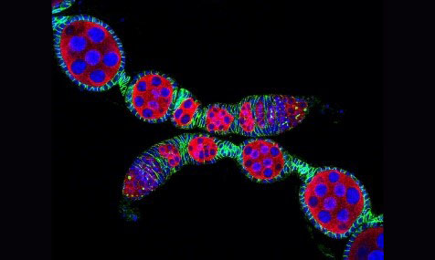 Two fruit fly ovaries that look like strings of red-and-purple beads.