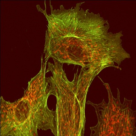 A treelike structure made up of red and green fibers.