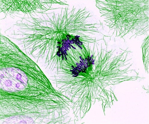 Webs of green lines pulling apart oblong purple structures.