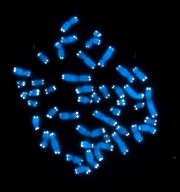 Chromosomes from a human cell, shown as pairs of glowing parallel lines on a dark background.