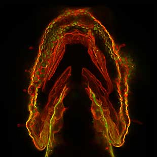 A spade-shaped group of cells glowing red, yellow, and green.