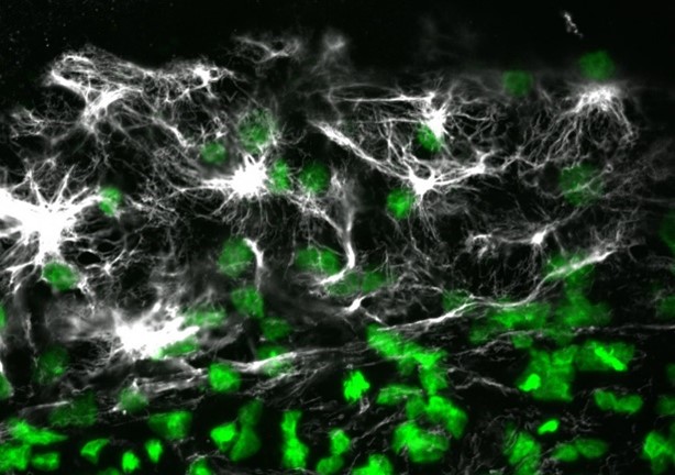 Weblike structures over a group of green spots.