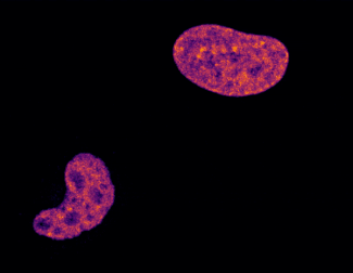 A round cell on the bottom left breaks apart into small pieces while another cell on the top right splits into two cells.