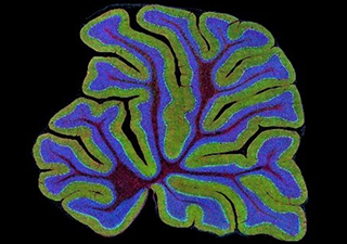 A coral-like piece of cerebellar tissue.