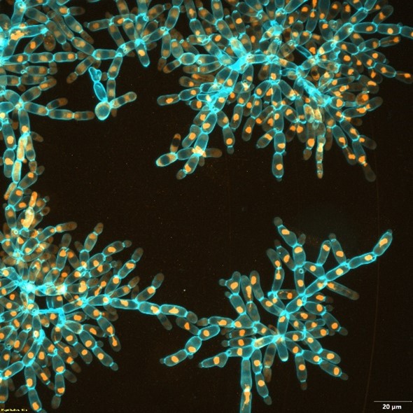 Turquoise-colored oval cells connected to each other at the ends to form branching, 3D structures.