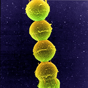 A chain of seven connected yellow-green spheres on a purple background.