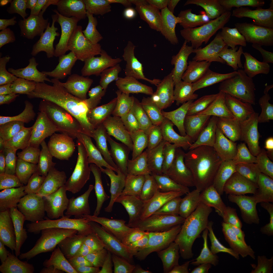 Irregularly shaped cells in multiple colors.