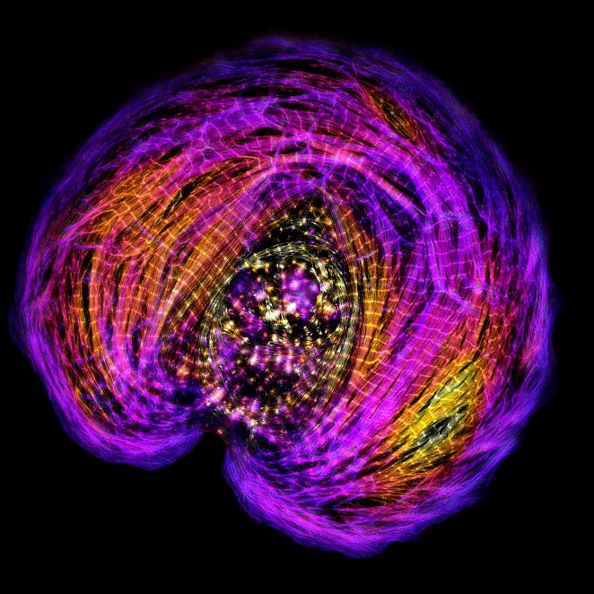 A round cell (in hues of magenta, yellow, and orange) that contains many perpendicular lines at repeating intervals. 