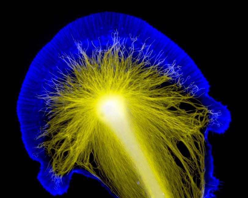A mushroom-shaped structure containing many thin, yellow fibers that extend from a long, thick bundle of yellow fibers. A blue halo surrounds the entire structure.