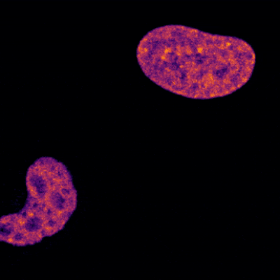 Two purple- and orange-speckled ovals (cells). The bottom left cell shrinks and becomes several bright yellow circles. The top right cell morphs into thick, bright yellow strands that align along the center of the cell and then pull apart into two new cells.