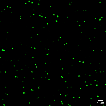 Small green dots grouping into larger green clumps.