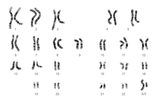 Chromosomes shown as 23 sets of squiggly lines, descending in size.