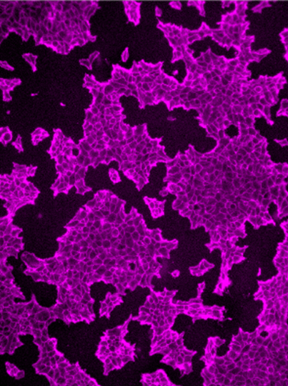 A range of irregularly shaped, purple molecules. 