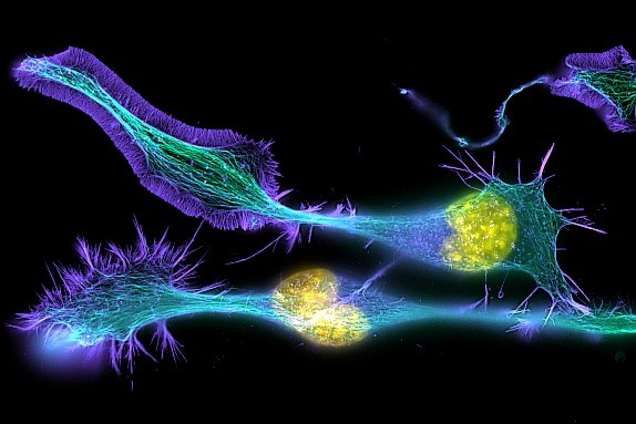 Cells shown as long green strands with yellow bulges on one side and purple projections off the other.