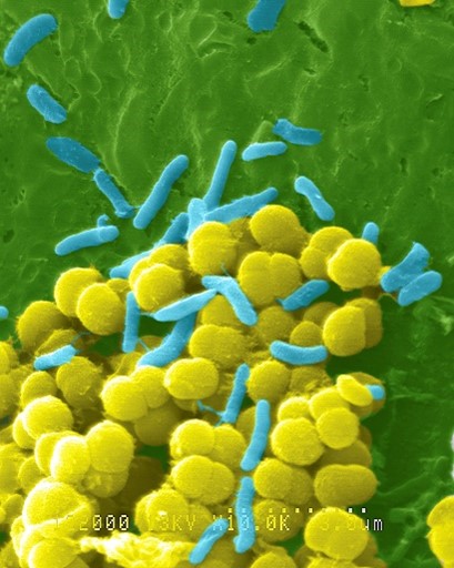 Bacteria shown as many yellow spheres and light blue rods on a green background. 