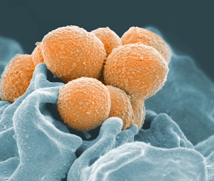 Bacteria, shaped as a cluster of orange spheres with bumpy surfaces, on top of an uneven surface.