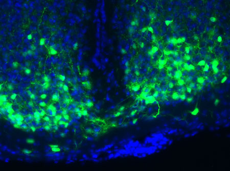Master clock in mouse brain with the nuclei of the clock cells shown in blue and the VIP molecule shown in green. Credit: Cristina Mazuski in the lab of Erik Herzog, Washington University in St. Louis.