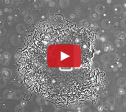 Expanding circle in the movie show the periodic stops in the growth of a bacterial colony.