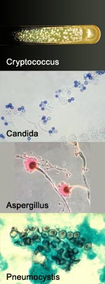 Top to bottom: Cryptococcus, Candida, Aspergillus, Pneumocystis