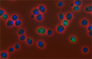 Sample slide, variability of mRNA in yeast cells
