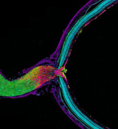 Mouse optic nerve and retina. Credit: Keunyoung Kim, Thomas Deerinck and Mark Ellisman, National Center for Microscopy and Imaging Research, UC San Diego.